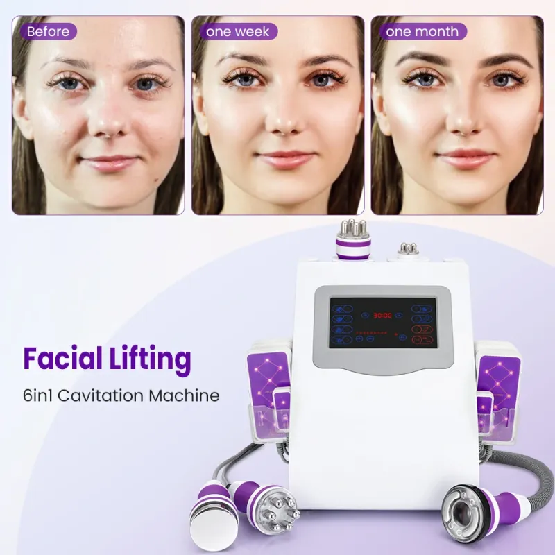 Best Ultrasonic Cavitation for Home Use-Unoisetion 6 in 1